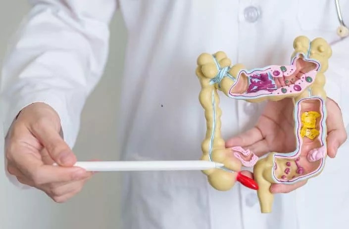 Tratamientos y campañas impulsan una mejor calidad de vida a pacientes con enfermedades inflamatorias&nbsp;intestinales